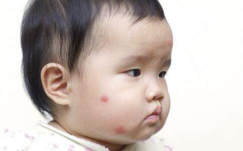 山东国康全自动母乳分析仪厂家—母乳能治疗宝宝的湿疹吗