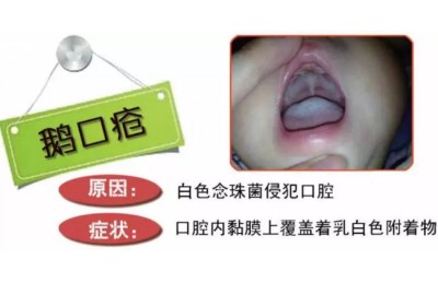 全自动母乳分析仪厂家找到母乳喂养疼痛原因-山东国康 全自动母乳分析仪厂家找到母乳喂养疼痛原因-山东国康